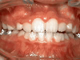 phase 1 after phase 1 after