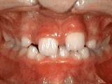 phase 1 before phase 1 before