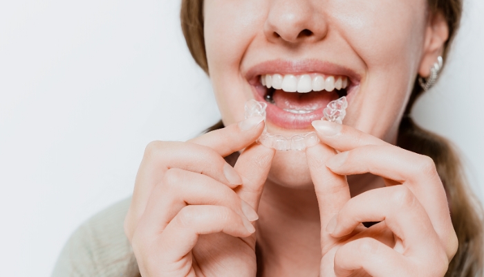 Straighten Your Smile with Clear Aligners